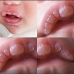 If your baby has these marks it means… See more
