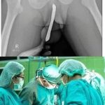 Doctors are speechless: Just boil these 2 8 and you will quickly lose your body fat !!